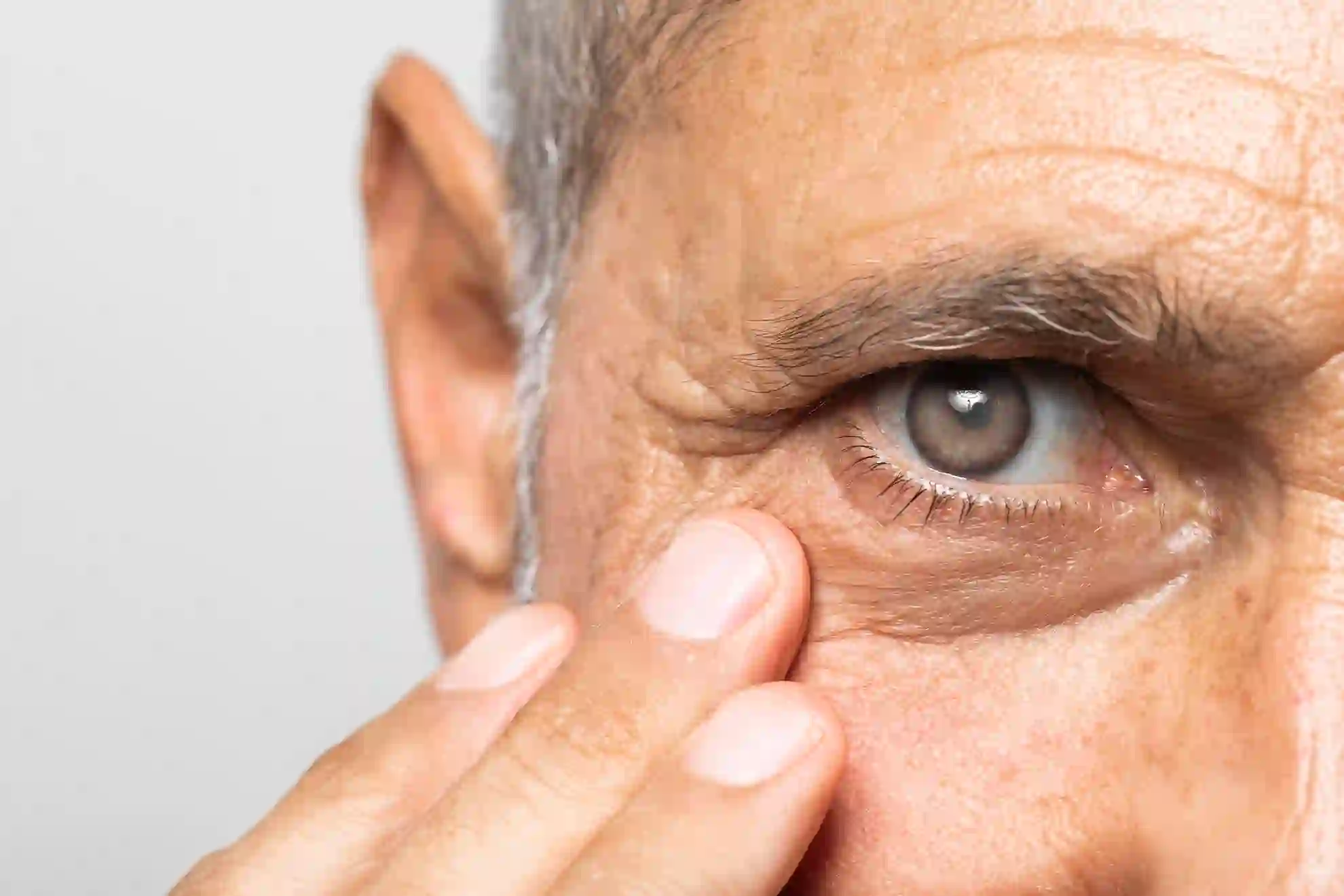 Cataract Signs and Symptoms